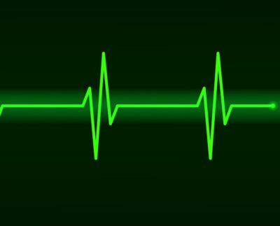 Sick Sinus Syndrome