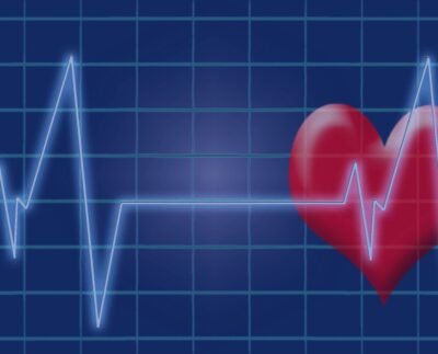 respiratory sinus arrhythmia